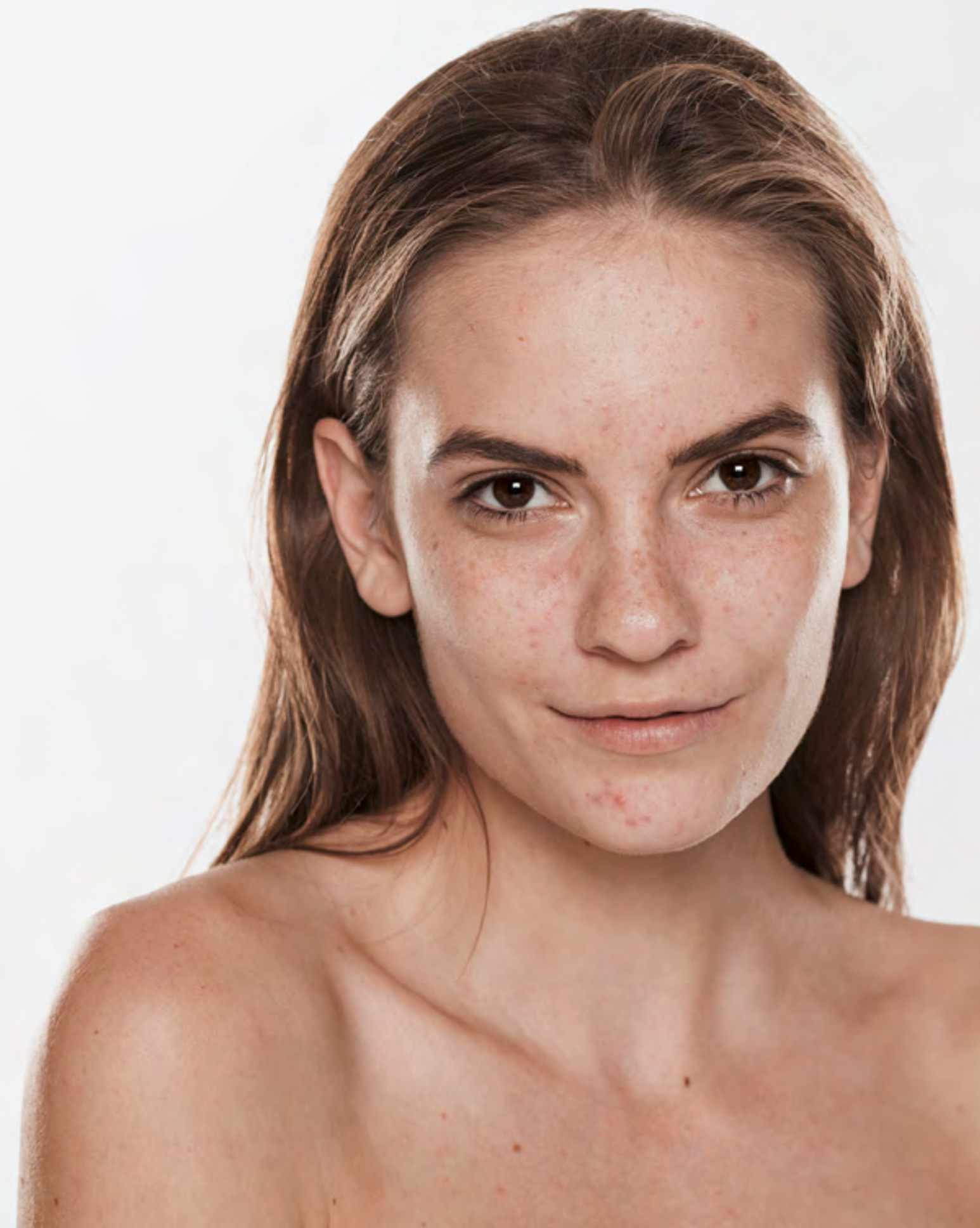 haut in der pubertaet