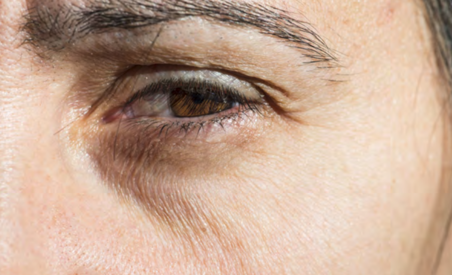 stress auswirkung auf haut