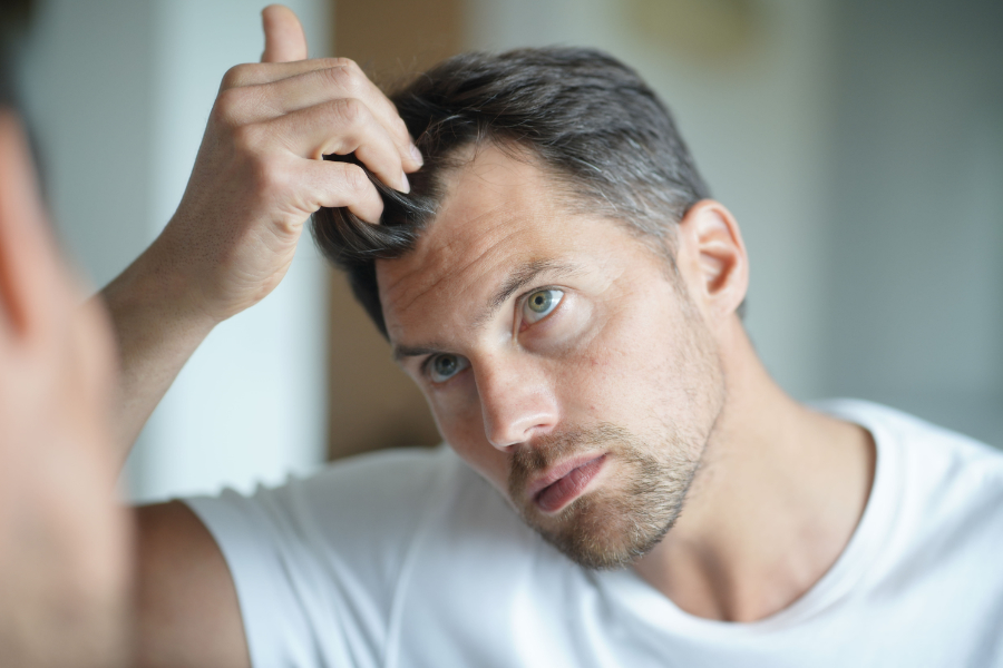 Mann mit Haarverlust