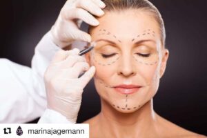 Marina Jagemann facelift skinmed
