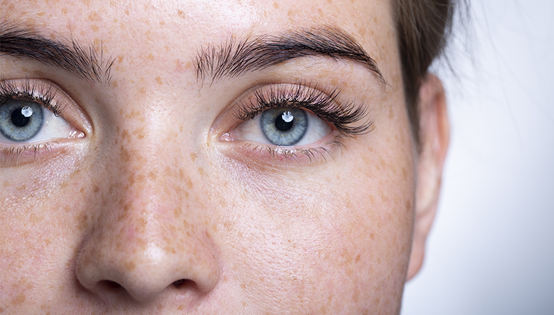 Skinmed_Augenlidstraffung