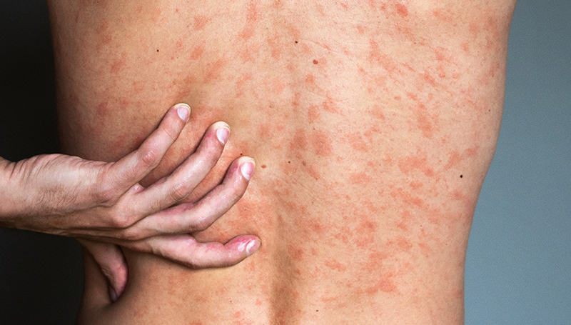 Skinmed_Allergien und Unverträglichkeiten