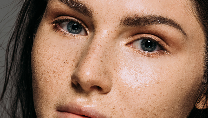 Skinmed Akne und Rosazea