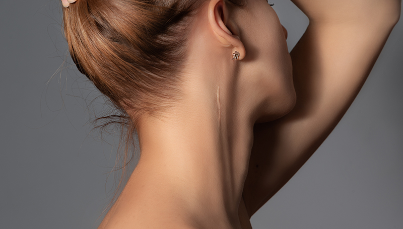 Skinmed Dermatologie Narben