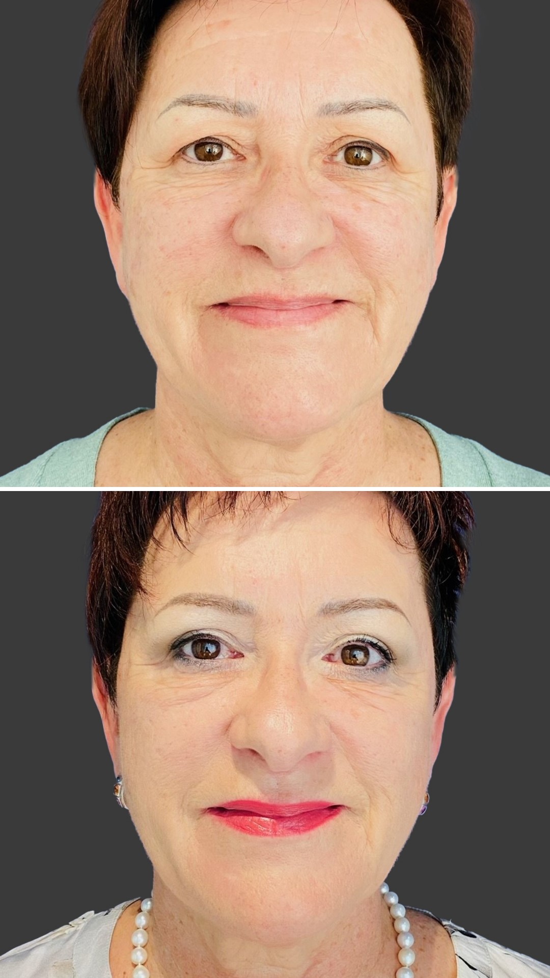 Skinmed_Dorota_Czerniak:_Oberlid_1_web